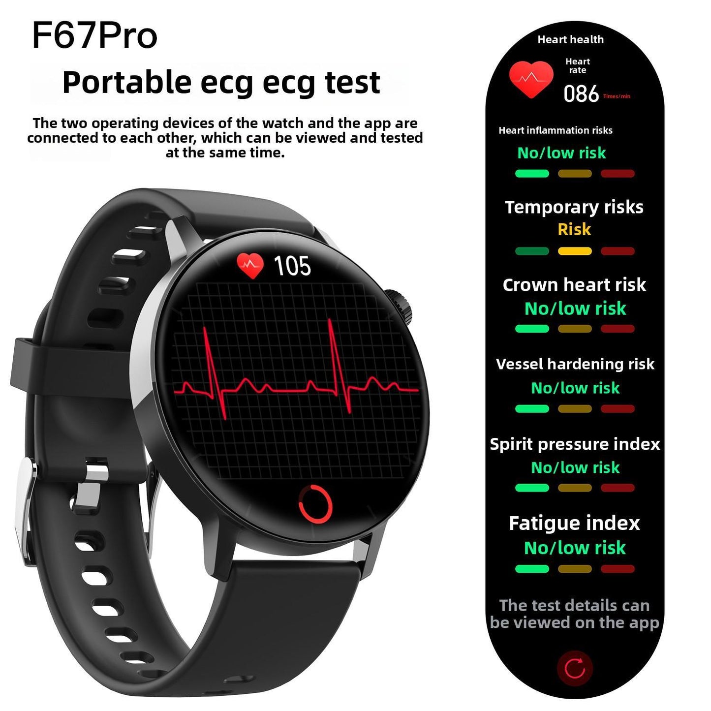 Smart Watch- Non-Invasive Blood Glucose Monitoring