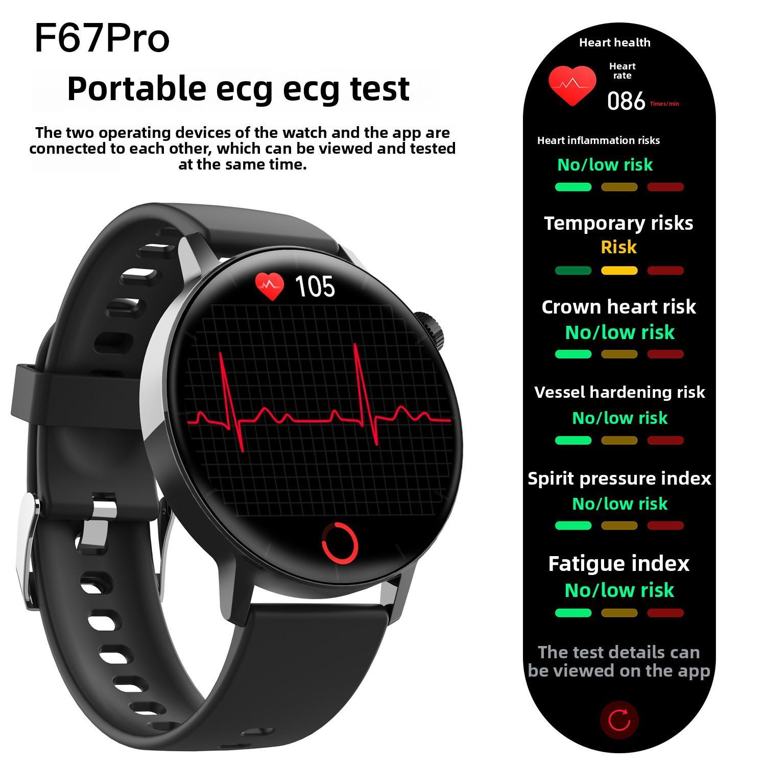 Smart Watch- Non-Invasive Blood Glucose Monitoring