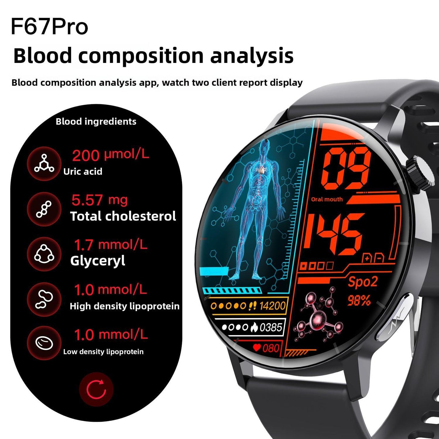 Smart Watch- Non-Invasive Blood Glucose Monitoring